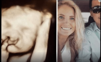 Doktori su mi rekli “abortus” kad su vidjeli bebin ultrazvuk: Nismo ih poslušali Moj sin danas ima 6 godina i izgleda ovako